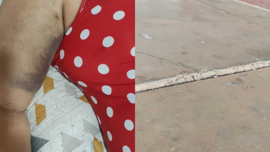 Idosa fratura braço em parque de Campo Grande devido a desnível