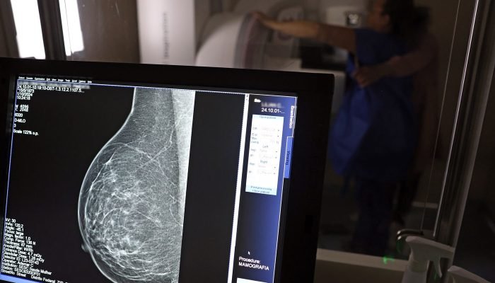 Outubro Rosa: Como receber auxílio-doença durante o tratamento de câncer