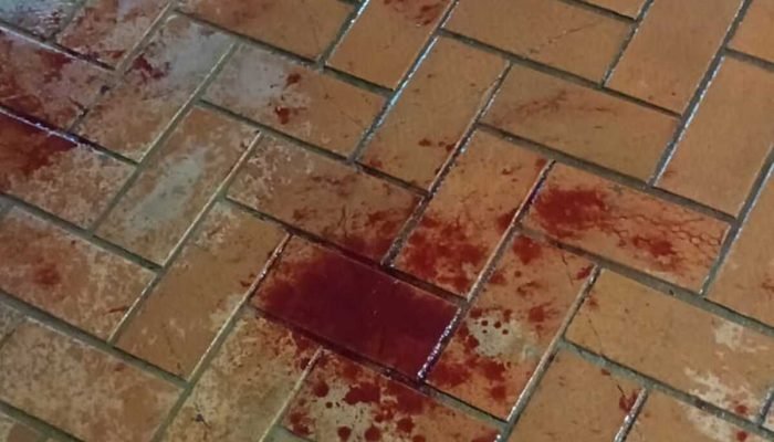 Homem persegue e esfaqueia adolescente que recusou relacionamento em Coxim
