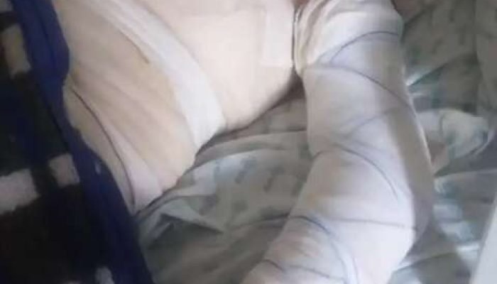 Homem é preso suspeito de queimar companheira de 17 anos em fazenda de MS