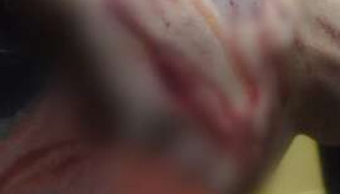 PM da reserva é acusado de agressão com taco em Campo Grande