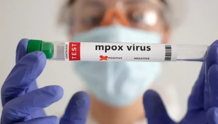 Em 2024, o Brasil registrou 2.052 casos de mpox - Foto: Agência Brasil