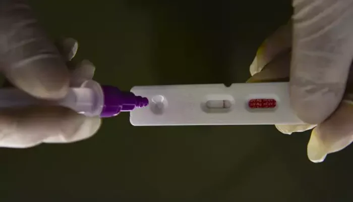 Exame de teste de covid-19 realizado pela secretaria de saúde (Foto: Divulgação)