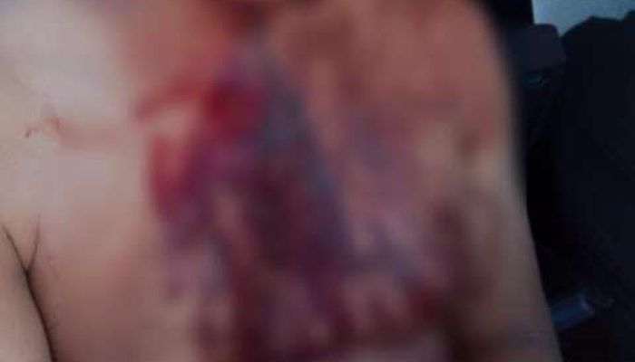 Vítima ficou ferida após ser atacada por criminosos — Foto: Vítima ficou ferida
