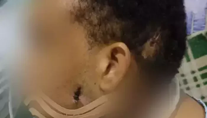 Pessoa com ferimentos no rosto e pescoço em ambiente hospitalar.