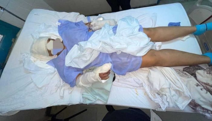 Mulher sobrevive a ataque com facão no Paraguai fingindo-se de morta