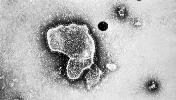 Vírus HPMV, descoberto em 2001 (Foto: CDC/EUA)