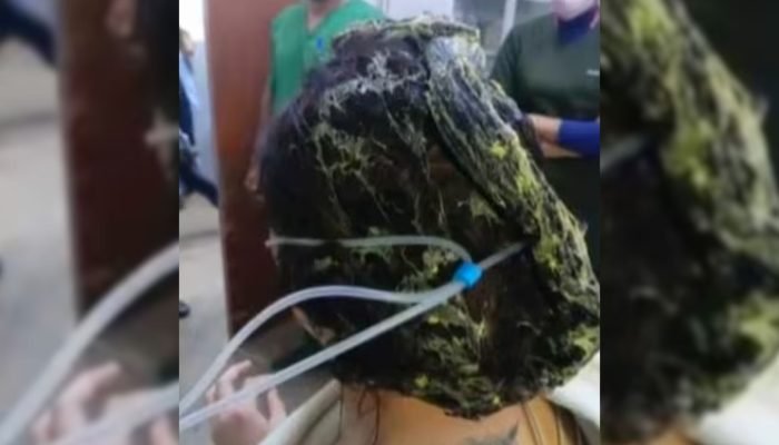 Cola grudada no cabelo da mulher. — Foto: Cola grudada no cabelo da mulher. (Rep