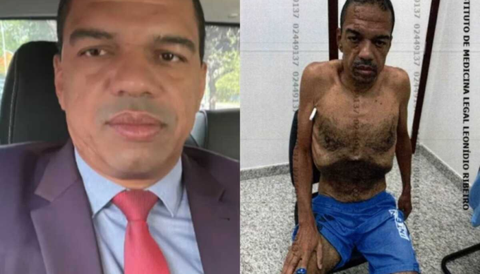 andreson-antes-e-depois-esquelet.png
