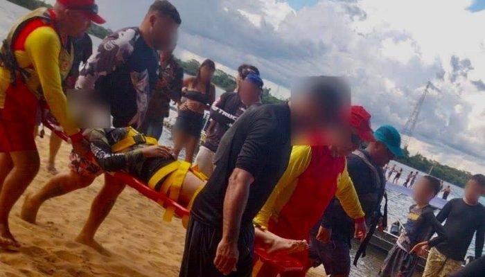 Acidente com jet ski na Ilha do Jurerê — Foto: Imagem: Pontal News