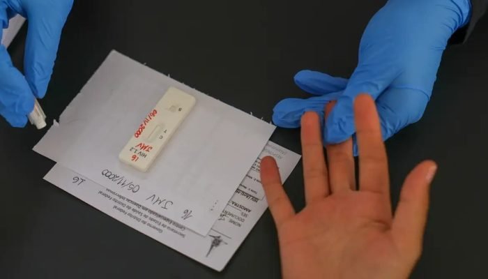 Mato Grosso do Sul e Brasil registram menor número de mortes por aids em décadas