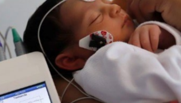 Ministério da Saúde lança novo Guia Nacional da Triagem Auditiva Neonatal