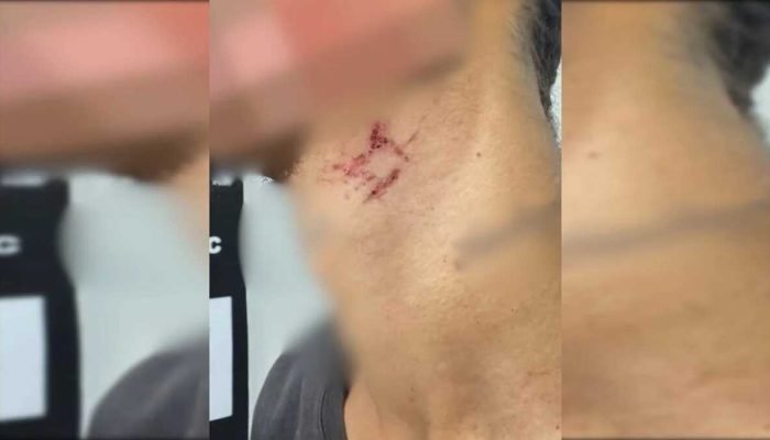 Jovem é resgatado após ser mantido como escravo sexual por mais de um ano em Goiânia