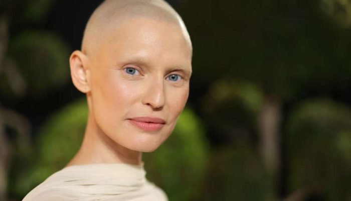 Modelo italiana revela negativa da Victoria's Secret para desfile durante tratamento de câncer