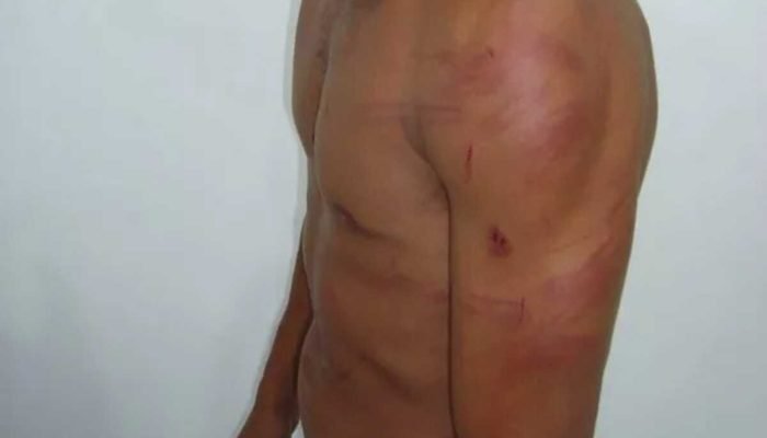 Mulher agride ex-companheiro durante discussão sobre relacionamentos passados em Campo Grande