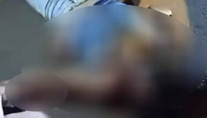 Foto: Jovem ficou em estado grave (reprodução)