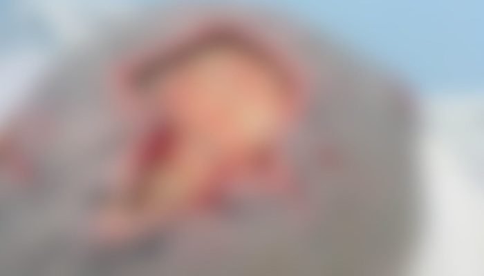 larvas-cabeca-Anastascio-foto-reproducao-leitor-Midiamax
