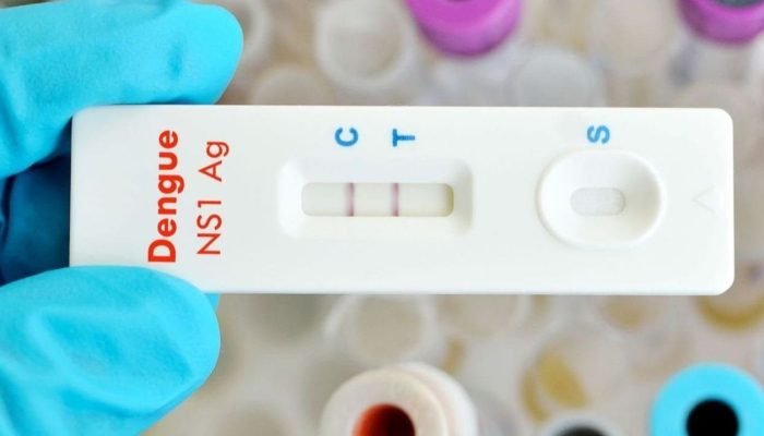 Teste rápido de dengue   (Foto: Divulgação)