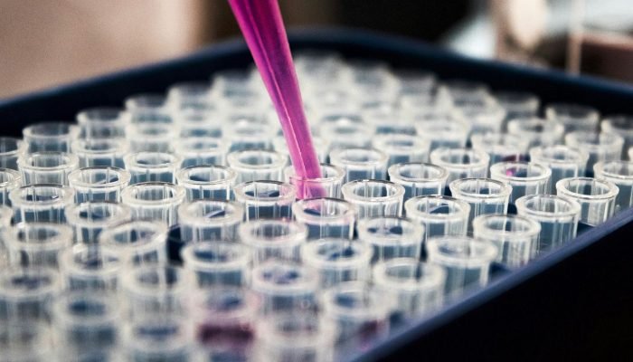 Exame de sangue apresenta avanço para detectar Alzheimer, apontam estudos