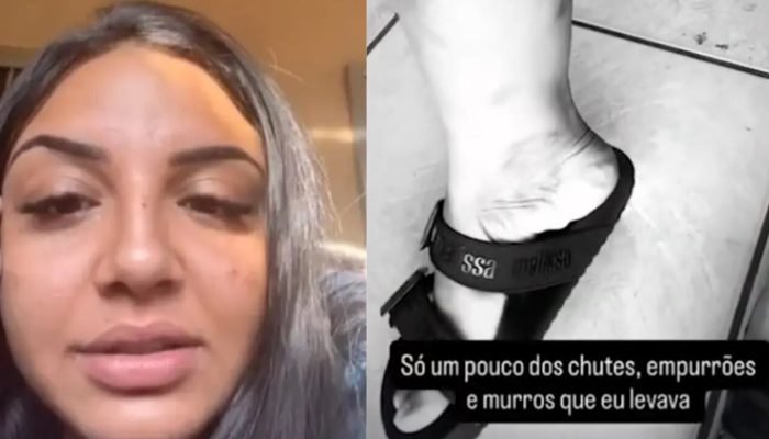 Ludmila mostrou marcas das agressões nas redes sociais — Foto: Ludmila mostrou m