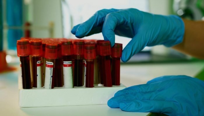 Cães farejadores são utilizados em estudos para detectar odores associados a doe