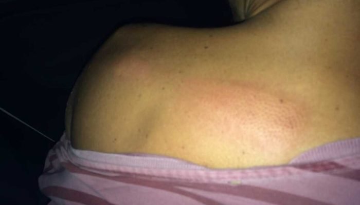 Vítima busca medidas protetivas após ser agredida por ex-companheiro em São Gabriel do Oeste