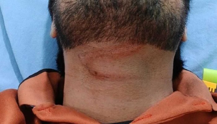 Motoentregador se fere ao ser atingido por cabo em Chapadão do Sul