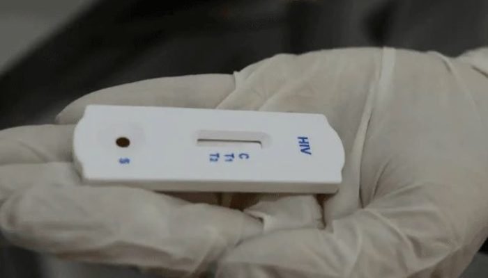 Foto: Teste de HIV | Rovena Rosa/Agência Brasil