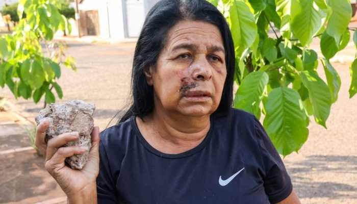 Idosa é atingida por pedra perto de rodoviária em Campo Grande