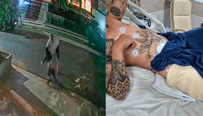 Vítima relata agressão, facadas e ofensas racistas em Campo Grande