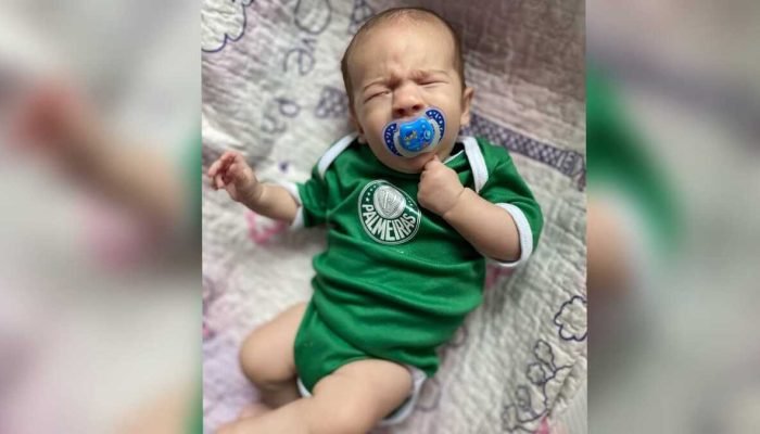 Bebê de MS com rara condição ocular precisa de apoio para tratamento em SP