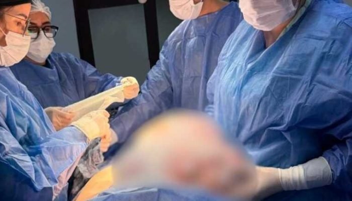 Fronteira: mulher tem tumor de 11 kg removido em cirurgia