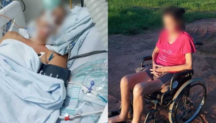 Paciente com rim necrosado aguarda cirurgia no SUS em Campo Grande