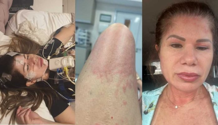 "Sei que vou morrer": mulher acusa ex, subtenente da PM, de ameaças e agressões em Campo Grande
