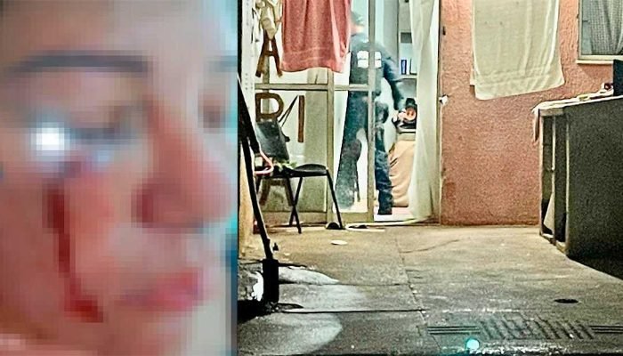 Mulher é brutalmente espancada um dia após se separar do ex-companheiro em Três Lagoas